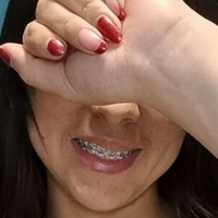 anadavilag9 Nue