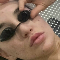 blakeblossomfree Nue