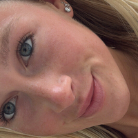 halledorann Nue