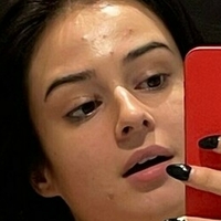Lauraysergii Nue