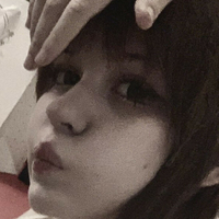 Nadecola9 Nue