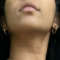 petitebabexo Nue