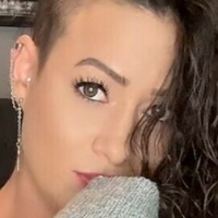 rocking_alopecia Nue