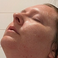 titlaser Nue
