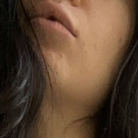 traversetina Nue