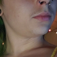 xxxanthisma Nue